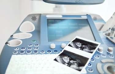 Ultrasound Monitoring in First Trimester of Pregnancy