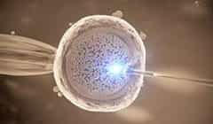 IVF Cost: USA vs Middle East vs Western Europe