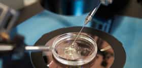 IVF with Own Oocytes & the Partner’s Sperm Cost in Czechia, Gynem Fertility Clinic
