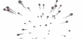 Sperm Preparation for AI: Sperm Washing, Swim Up, Density Gradient Centrifugation