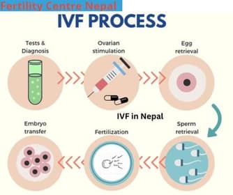 How IVF in Nepal procedure is performed?