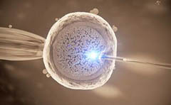 IVF Cost: USA vs Middle East vs Western Europe